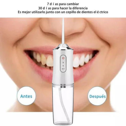 Irrigador Bucal Limpiador Dientes Eléctr